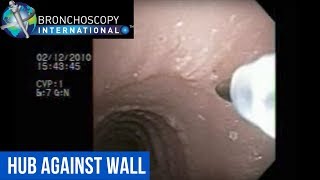 Flexible Bronchoscopy Basic Techniques 7 TBNA Hub Against Wall [upl. by Nosral978]