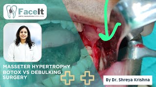 Treatment Of Masseter Hypertrophy  Botox Vs Debulking Surgery  Face Shaping  Dr Shreya Krishna [upl. by Nnaaihtnyc228]