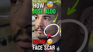 How Jose Aldo got His CRAZY Face Scar 😰 [upl. by Nelak]