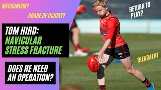 Navicular Stress Fracture Essendon Bombers Tom Hird  Injury Analysis [upl. by Vivyanne]