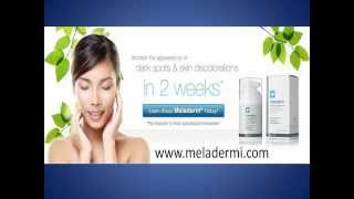 Meladerm Cream Reviews  My Experience Facts On Meladerm [upl. by Sirromaj]