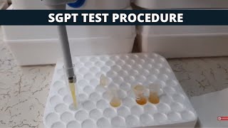 SGPT Test Procedure  SGPT Simple Test Procedure [upl. by Otrebla434]