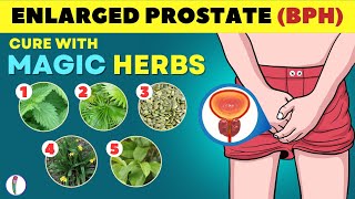 🔥 Magic Herbs to Cure Enlarged Prostate  Prostate enlargement Treatment  BPH Treatment [upl. by Abdel]