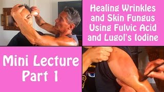 Healing Wrinkles and Skin Fungus Using Fulvic Acid and Lugols Iodine Part 1  Dr Robert Cassar [upl. by Luann526]