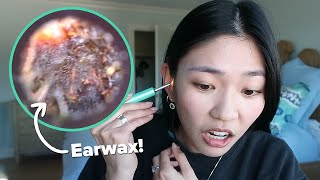 We Used An Earwax Cleaning Camera For The First Time [upl. by Anirtek]