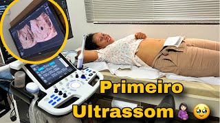 PRIMEIRA CONSULTA do PRÉ NATAL🤰🏻O PRIMEIRO ULTRASOM  FAZENDO EXAMES E VACINAS😭🥹 [upl. by Kcirdorb394]