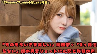 「ものもらいさえ美しい」岡田奈々「3ヶ月治らない」顔の異変ショットに心配と称賛の声 [upl. by Eerahs]