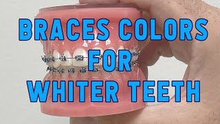 Braces colors for WHITER teeth [upl. by Ahsot]