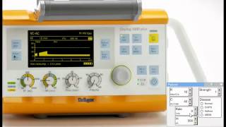 Using the Oxylog 3000 simulator to show patient ventilator asynchrony [upl. by Ahteres395]