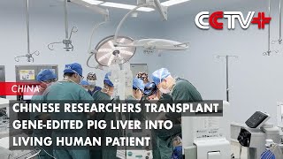 Chinese Researchers Transplant Geneedited Pig Liver into Living Human Patient [upl. by Ettennor710]