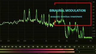 Acoustic Tinnitus Treatment  Binaural Modulation Sounds for Tinnitus Relief [upl. by Ragland]