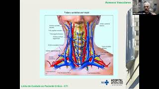 Acessos Vasculares Rotinas HMDCC [upl. by Henghold567]