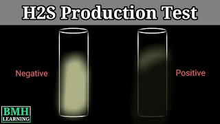 Hydrogen Sulphide Production Test  H2S Production Test [upl. by Atims]