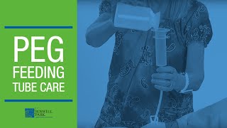 PEG Feeding Tube Care Instructions  Roswell Park Patient Education [upl. by Moreta]