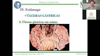 Gastrites e úlceras gástricas [upl. by Nauqyaj]