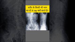 शरीर के किसी भी भाग का दो X ray क्यु करते है anatomy [upl. by Betteanne]