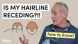 Decoding Hair Loss Understanding the Norwood Scale [upl. by Camilia]