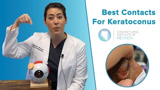 Best Contact Lenses For Keratoconus [upl. by Inah535]