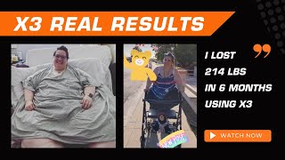 Woman Loses 214 lbs with X3 Bar In Just 6 Months [upl. by Dee Dee]