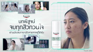 บทพิสูจน์จบทุกปัญหาสิวกวนใจ ผ่านประสบการณ์ของผู้ใช้จริง [upl. by Eleira]