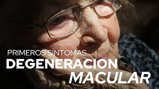 ¿Que es la MACULOPATIA o DEGENERACIÓN MACULAR¿Cuáles son los sintomas Dr Alejandro Lavaque [upl. by Medorra880]