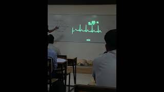 SVT with Synchronised Cardioversion Class  ACLS  PGDEMS Symbiosis Noida  13th August 2023 [upl. by Ansela345]