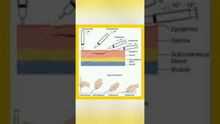 Route  technique of injection administration 💉knowledge easylearning shortsvideo shayari [upl. by Von]