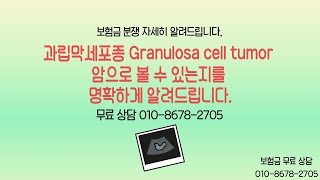 과립막세포종 Granulosa cell tumor 암으로 볼 수 있는지를 명확하게 알려드립니다 보험금 무료 상담 TEL 01086782705 과립막세포종난소과립막세포종 [upl. by Yhtimit]