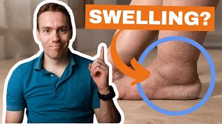 The 1 Best Natural Remedy for Swollen Feet and Ankles [upl. by Knowlton]