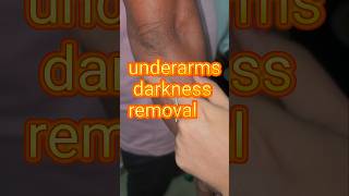 Underarms darkness removal [upl. by New]