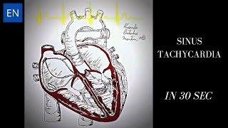 Sinus Tachycardia Animation and ECG Shorts [upl. by Anitsirt522]