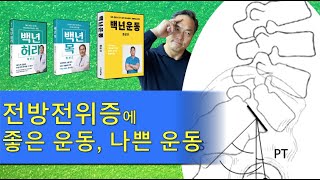 백년허리 기초편 전방전위증에 좋은 운동과 나쁜 운동 [upl. by Akfir]