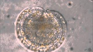 the dinoflagellate Ptychodiscus noctiluca [upl. by Assirec]