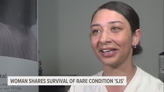 West Michigan woman shares her story about rare condition that almost took her life [upl. by Larner786]