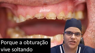 Bruxismo solta restaurações Master Pride Odontologia  Dra Bianca Rosa [upl. by Yeltihw698]