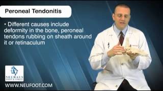 Peroneal Tendinitis is a Common Running Injury [upl. by Granniah]