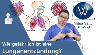 Lungenentzündung Wie gefährlich ist die Pneumonie Hygiene amp Prophylaxe sowie Symptome amp Therapie❗ [upl. by Notliw]