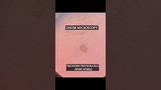 Trichuris trichura Eggparasitic eggsshorts trending [upl. by Anyr]