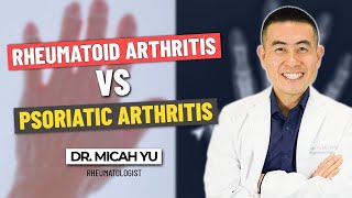 Rheumatoid Arthritis RA vs Psoriatic Arthritis PA  Rheumatologist Dr Micah Yu [upl. by Anirehtak916]