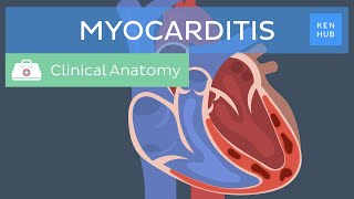 Myocarditis Causes symptoms diagnosis treatment and prognosis  Kenhub [upl. by Cassandre599]