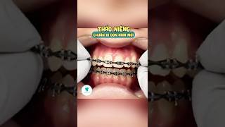 braces niengrang niengrangmaccai nhakhoaopal nhatrang [upl. by Henghold]