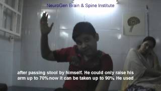 Duchenne Muscular Dystrophy Treatment in India [upl. by Aciret]