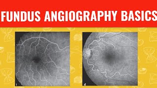 FFA course  FUNDUS FLUORESCEIN ANGIOGRAPHY [upl. by Ploch250]