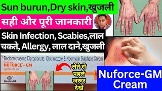 nuforce gm cream  nuforce gm  nuforce gm cream uses in telugu  nuforce gm cream kannada  Nuforce [upl. by Acilef]