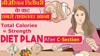 सिजेरियन डिलीवरी के बाद क्या खाये और क्या खाने से बचे  Diet Food After Cesarean Delivery [upl. by Nirak715]