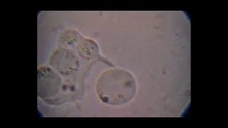 Trichomonas hominis con Blastocystis fagocitados e intento de fagocitosis de otro [upl. by Lemhar]