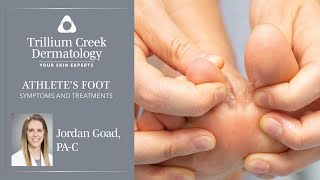 What is athletes foot and how is it treated [upl. by Adnolohs]