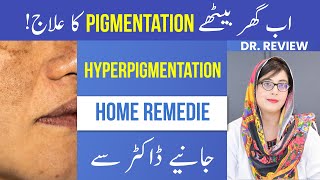 Treat Pigmentation At Home  Home Remedies For Hyperpigmentation  Pigmentation Ka Ilaaj  DrReview [upl. by Ignacio]