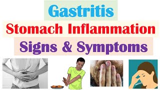 Gastritis Stomach Inflammation Signs amp Symptoms Complications amp Why They Occur [upl. by Siro]