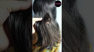 aloe vera hair mask to stop hair fallthinning hair and for faster hair growthAyesha Qamar shorts [upl. by West]